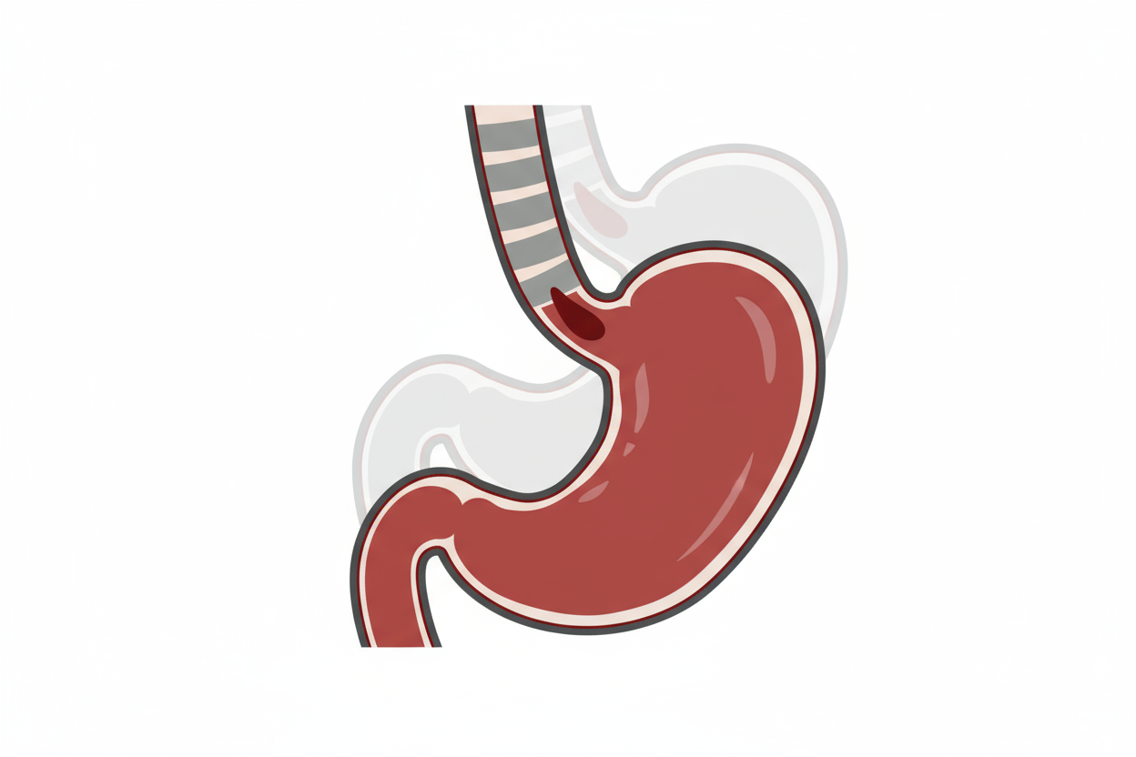 GERD (Gastro Esophageal Reflux Disease) Recovery Nutrition